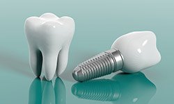 Animation of natural tooth and implant supported dental crown